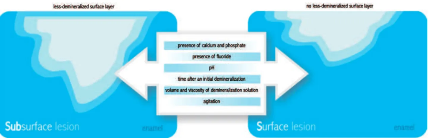 Figure 7- Factors that affect the formation of subsurface lesions (caries-like) and surface-softened lesions (erosion-like)
