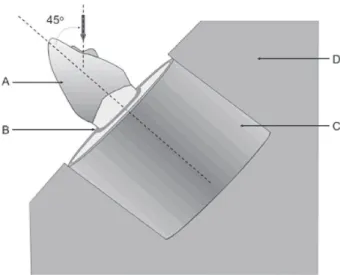 Figure 2- Schematic drawing of the specimen mounted in  an acrylic resin block; (A) metal crown; (B) silicon-simulated  periodontal  ligament;  (C)  resin  block;  (D)  metal  device