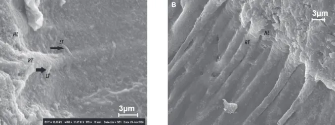 Figure  1-  Etch-and-rinse  adhesive  systems  -  adhesion  strategies according to the number of steps