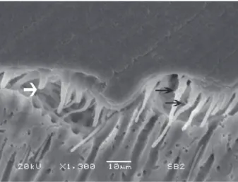 Figure 3- An adhesive defect can be seen in this image. 