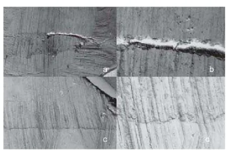 Figure 3- A – Panel of SEM micrographs of a tooth retrofilled with MBPc. a - MBPc apical plug (original magnification ×35);