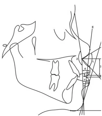 Figure 1- Definitions of abbreviations of the cephalometric variables evaluated in this study