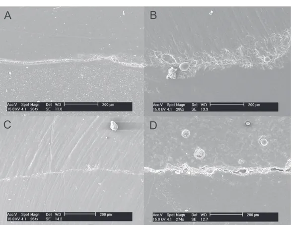 Figure 1- Marginal adaptation in enamel margins: A – G1 (Composite resin/conventional light-curing technique): a thin marginal gap was observed between the enamel and the composite restoration throughout the interface, similar to a superficial crack