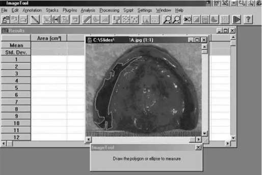 Figure 1- Stained regions were measured using image processing software (Image Tool 2.02)