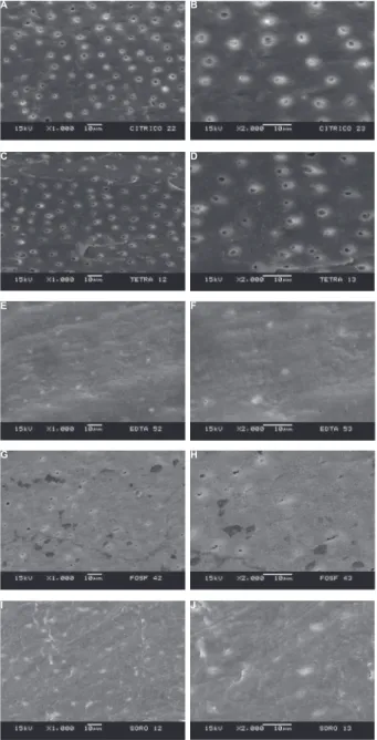 Figure 2- Panel of scanning electron microscopy (SEM)  micrographs. A: representative specimen of the Ca group  in which no smear layer can be noted and dentin tubules      ! "#   