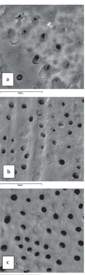 Figure 2- Representative scanning electron microscopy   micrograph of dentin surface (a) before immersion in the  acid solution, in the presence of smear layer; (b) after  immersion in acid solution and treatment with 10% propolis  gel; (c) after immersion