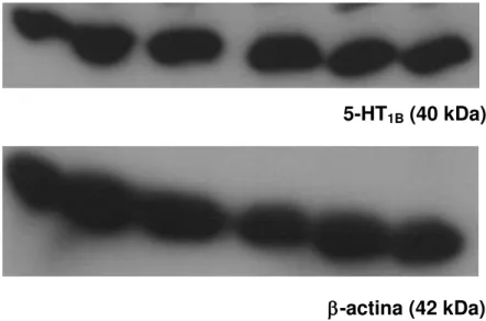 Figura 5 -  Expressão de receptores 5-HT 1B  e -actina em tecido de pata de ratos. 5-HT1B (40 kDa) 
