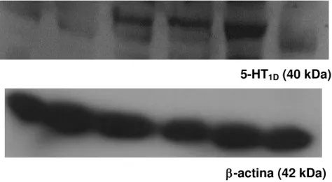 Figura 6 -  Expressão de receptores 5-HT 1D  e -actina em tecido de pata de ratos.