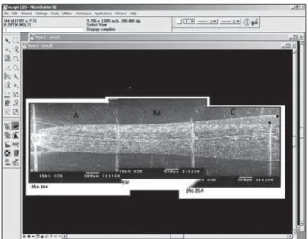 Figure 2- Scanning electron micrographs of the cervical  (C), medium (M) and apical (A) thirds combined using  '*"!/ <=>