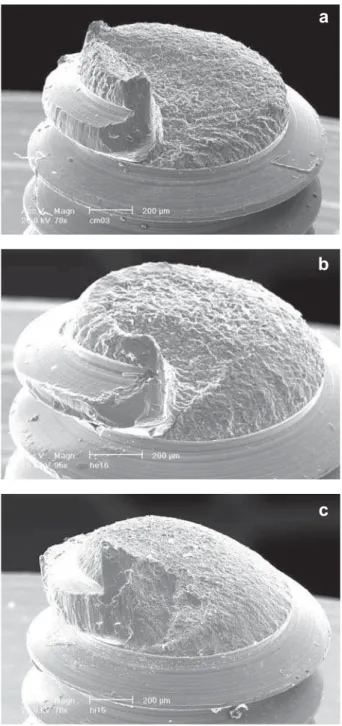 Figure 7- Scanning electron microscopy (SEM) micrograph  images of prosthetic screws showing the same mode of  fracture to all the types of implant-abutment interfaces (a-  cone-in-cone; b- external hexagon and c- internal hexagon)