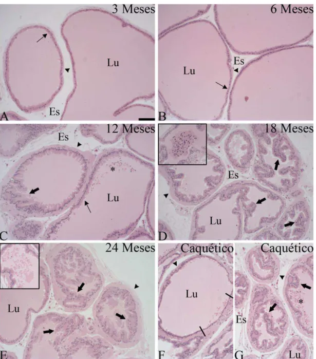 Figura 9: Histopatologia da próstata dorsal de ratos Wistar em diferentes idades. Em C,  D, F e G destaca-se intenso pregueamento epitelial, sugestivo de hiperplasia