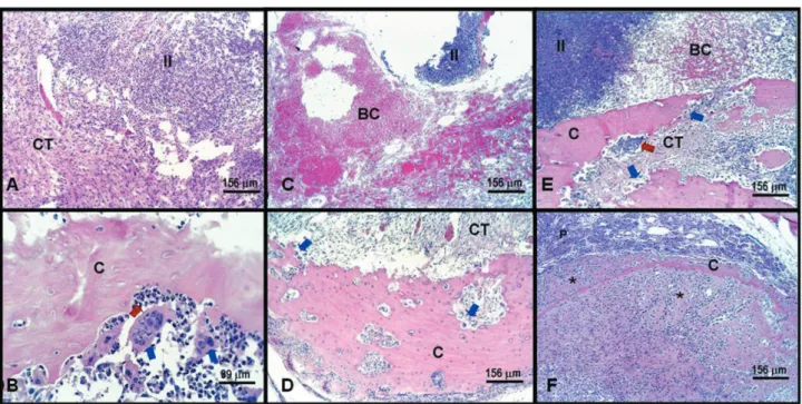 Table 2- Correlation analysis among the histometric parameters throughout the alveolar healing in non-infected and infected  rat sockets