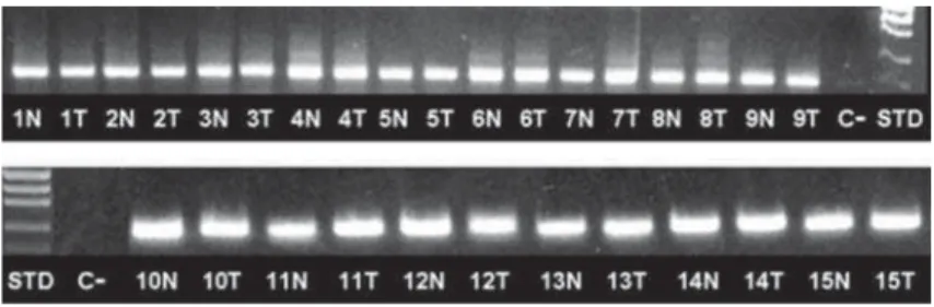 Figure 2-                   !    sample (patient); C-=Negative control (no template); STD=molecular weight standard; N=non-tumoral mucosa; T=tumor