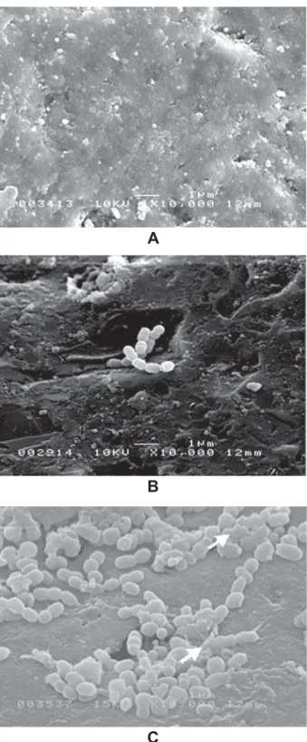Figure 2- Scanning electron microscope micrographs of  S. mutans cells grown on glass beads in the absence and  presence of 1% sucrose