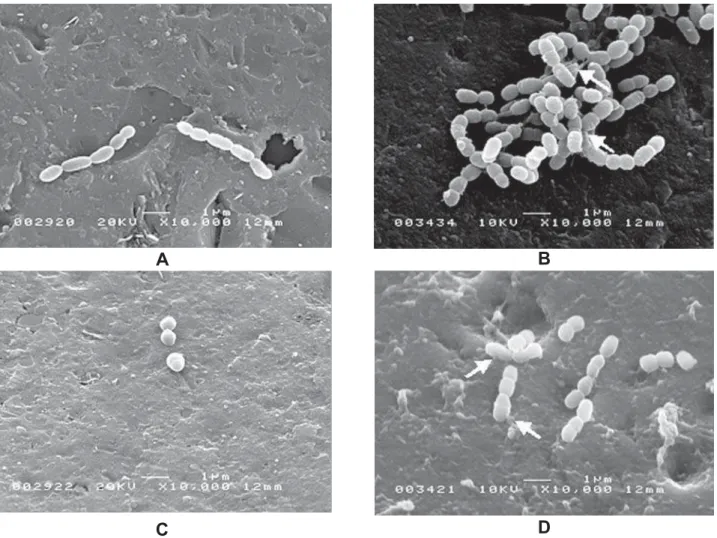 Table 3 shows the effect of the extract on      &amp;@  $ *  Figure 3- Scanning electron microscope micrographs of S