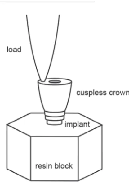 Figure 3- Prosthetic abutments used in the study. (1)  UCLA Gold Abutment – groups 1 and 4; (2) Internal  Hexagon Premachined Ti – group 2; (3) Internal Octagonal  Premachined abutment – group 3; (4) Ceraone Ti – group 5