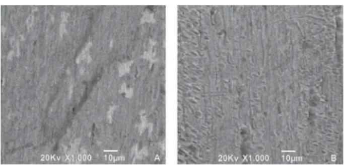 Figure 5- Scanning electron microscopy micrograph  showing surface topography of SS wire (associated with  MB) before (A) and after (B) mechanical traction