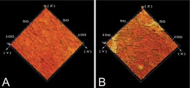 Figure 3- Confocal laser scanning microscopy topographical images. A: root surface treated with hand curettes showing 