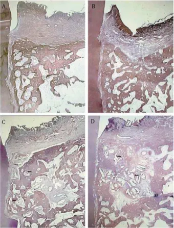 Figure 3- Photomicrographs of the treated 3-wall intrabony  defect showing new bone and cementum formation  extending coronally to the apical notch (H&amp;E, original      Note the remaining particles of BG surrounded by new bone  and connective tissue (C 