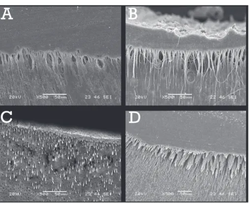 Figure 2- Scanning electron microscopy images (SEM) (magniication 500x, bar 50 μm) from a representative push-out  tested on dentin slice specimens: (A) Experimental Group 1; and (B) Experimental Group 2 showed an evident hybrid layer  with long resin tags