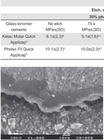 Figure 2- Scanning electron microscopy (SEM)  evaluation indicated cracks in certain areas of bonding  between adhesive and conventional glass-ionomer  cement (C-GIC)