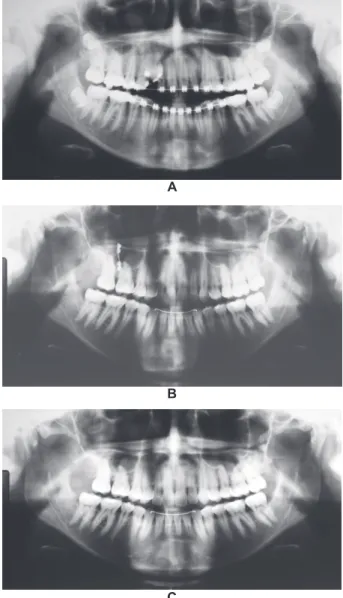 Figure 4- Periapical radiographic sequence. A. 