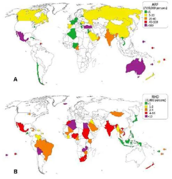 FIGURA  1  -  Mapa  da  distribuição da febre reumática aguda (A)  e cardiopatia  reumática crônica (B) no mundo, com base em dados de 1991 até o  presente 