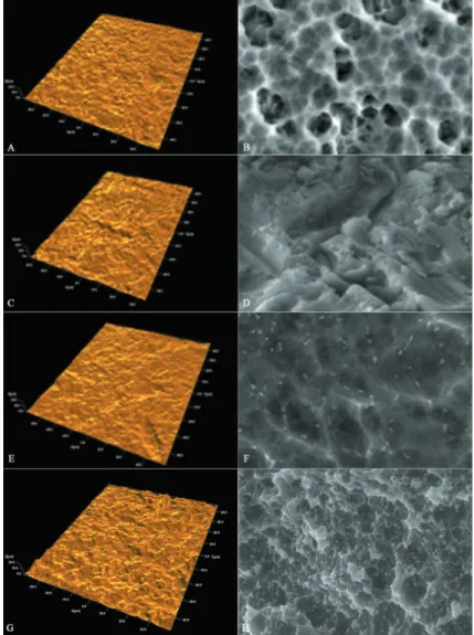 Figure 2- a, b and c: Filter sequence in which the undulations and shapes have been removed