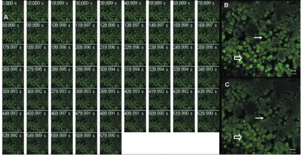 Figure 1-  S. mutans  bioilm on dentin surface after saline application (control group) visualized by confocal laser scanning  microscopy (CLSM)