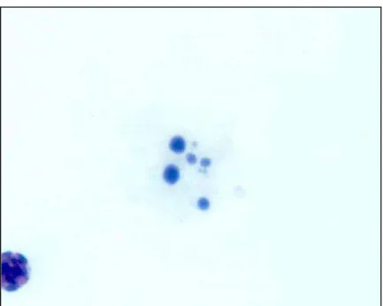 Figura 16 - Fotomicrografia de linfócito em necrose corado por Giemsa (observado sob  aumento de 1000 X)