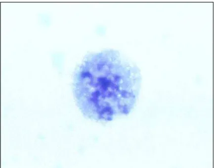 Figura 18 - Fotomicrografia de linfócito em necrose corado por Giemsa (observado sob  aumento de 1000 X)