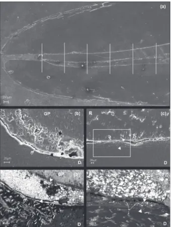 Figure 2- Scanning electron microscopy (SEM)  micrographs using secondary electrons (SE) and back  scattered electrons (BSE) mode of the replica and the  section of the same specimen, respectively