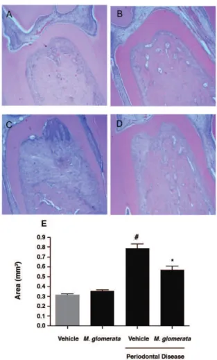 Figure 1-  Mikania laevigata extract (MLE) decreases  alveolar bone resorption. Histology at the furcation of irst  molars sampled from the rats euthanized after 30 days  of experiments is shown [hematoxylin and eosin(HE)  staining]; (A) non-ligated animal