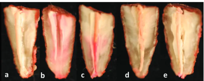 Table 1- Comparison of mean dye leakage values (mm)  and standard deviations (SD) of the endodontic sealers