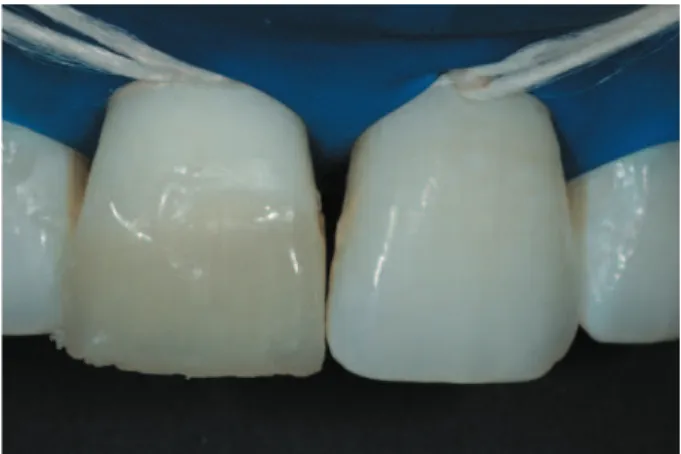 Figure 10- Final esthetic outcome