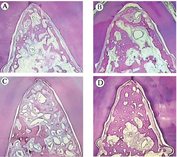 Figure 3- Mesiodistal histologic section of Class II furcation lesion stained with hematoxilyn and eosin (H&amp;E), (original    !&#34;  #$%'*$+/6 * Site of the test group guided-tissue regeneration + bioactive glass + platelet-rich plasma (GTR+BG+PRP) aft