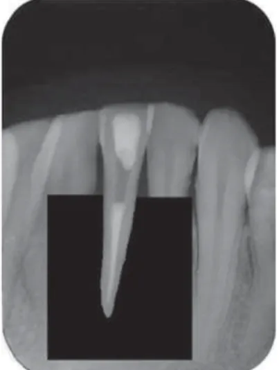Figure 1- )*!;<