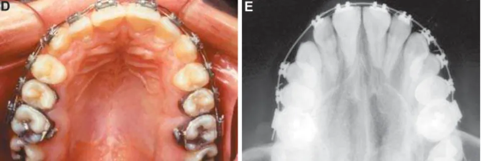 Figure 4-4-DE A C F DG H EB