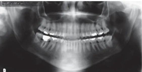 Figure 11- Panoramic radiograph