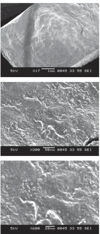 Figure 3- Scanning electron microscopy (SEM) view of  group A sample. A: SEM view of group A sample at 300x            