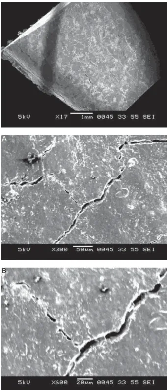Figure 5- Scanning electron microscopy (SEM) view of  group C sample. A: SEM view of group C sample at 300x         !    