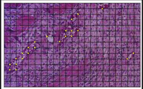 Figura  5  –  Contagem  de  vasos  sanguíneos.  Grade  histométrica  utilizada  para  a  contagem  do  número  de  pontos  (interseções  aqui  indicadas  em  amarelo)  ocupados  pelos vasos sanguíneos