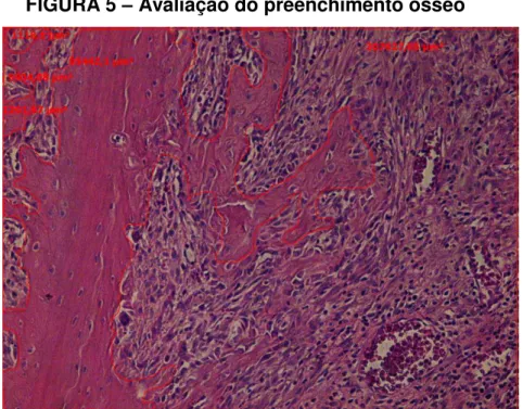 FIGURA 5  – Avaliação do preenchimento ósseo