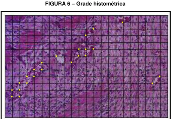 FIGURA 6  – Grade histométrica 
