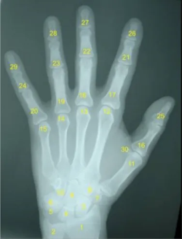 Figura  1. Radiografia  da  mãe  e  do  punho.  Fonte:  Radiografia  da  mão  e  do  punho  do  aluno  RCS;  Uningá, Curitiba,  2007