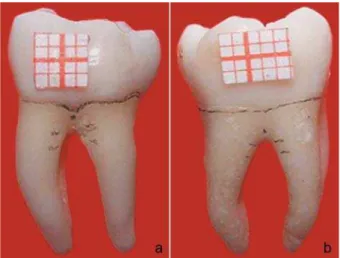 Figure 1- Buccal (a) and lingual (b) surfaces of a  mandibular molar with line and reference points