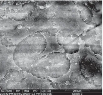 Figure 2- Scanning electron microscope (SEM)              Arrows indicate cells