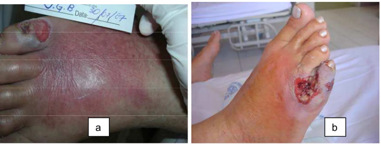 FIGURA 9 - Lesões infectadas 
