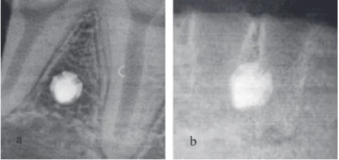 Figure 3- Histologic analysis at the implant-bone interface in the test group (lower panel) and control group (upper panel)  using Masson staining