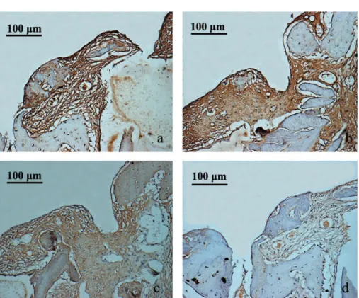 Figure 6- Immunohistochemical staining of Cbfa1 in sections from beagle mandible from test (a and c) and control groups  (b and d), during weeks 3 and 8